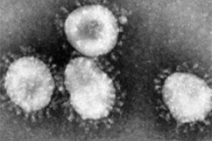 Бегству из госпиталя Чебоксар нашли дело